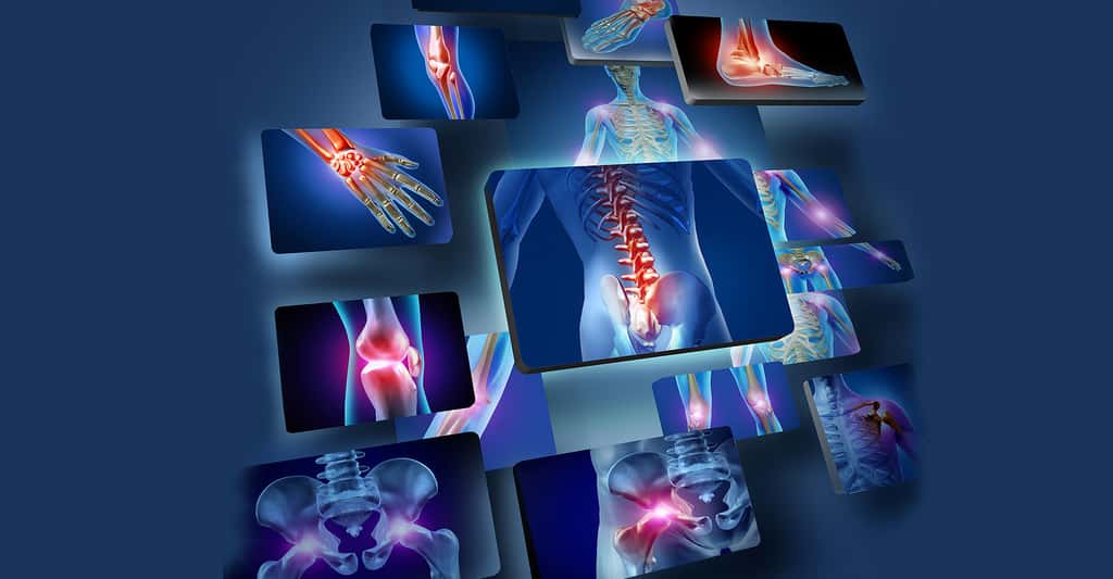 La fragilisation des os (ostéoporose) est un des effets de la ménopause, avec un plus grand risque de maladies cardiovasculaires. © Lightspring, Shutterstock