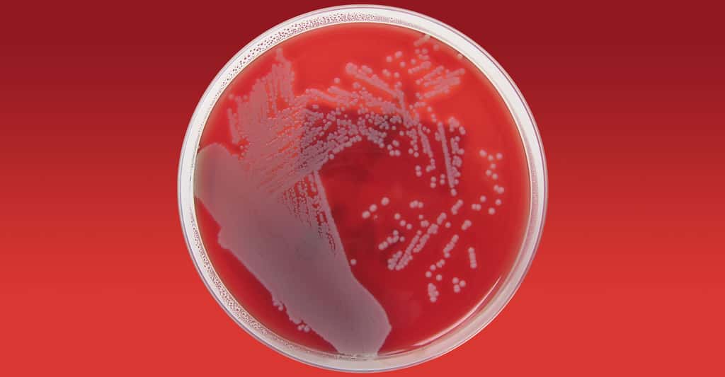 <em>Staphylococcus aureus.</em> © Nathan, CC BY 2.0