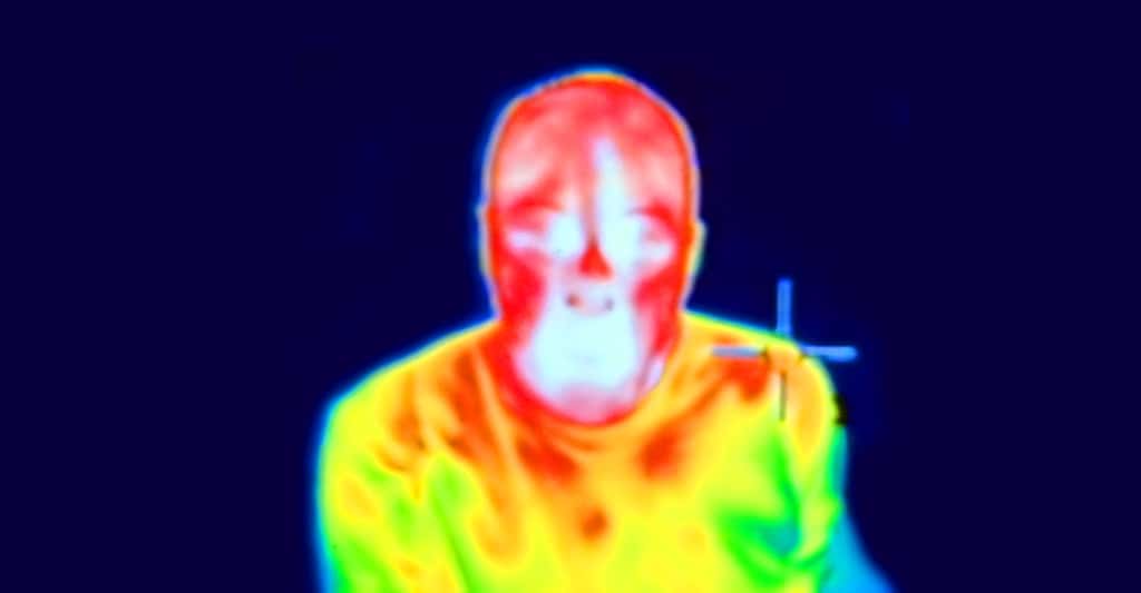 Visage vu en infrarouge. © Fæ, CC by-sa 3.0
