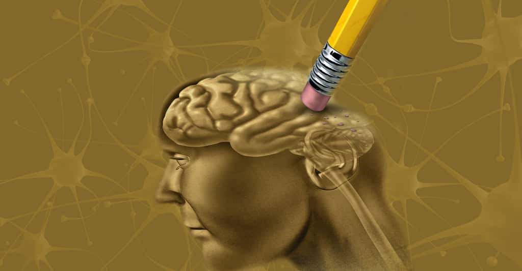 Maladie d’Alzheimer : espoirs thérapeutiques et prévention