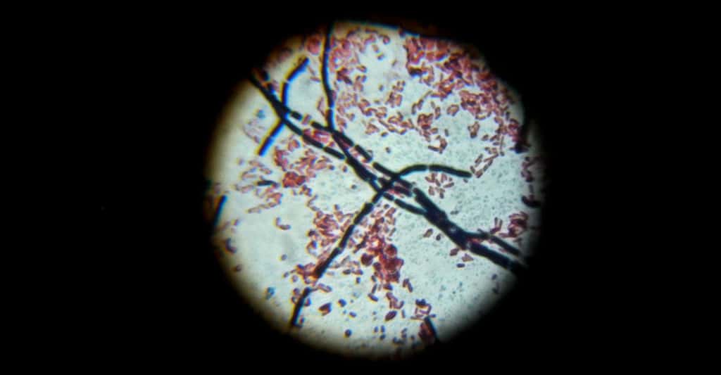 <em>Bacillus cereus </em>et <em>Escherichia coli</em>. © Bibliomaniac15 CC BY 3.0