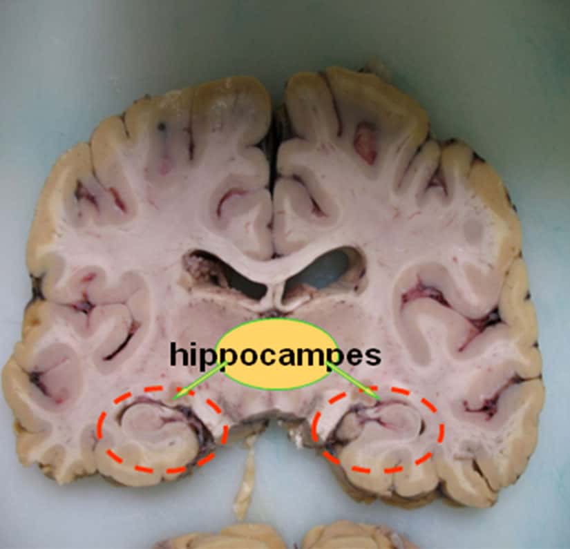 Neurones de l’hippocampe chez un rat. L’hippocampe est l’enregistreur des nouveaux épisodes dans notre mémoire. © Saikali, Lieury, 2013