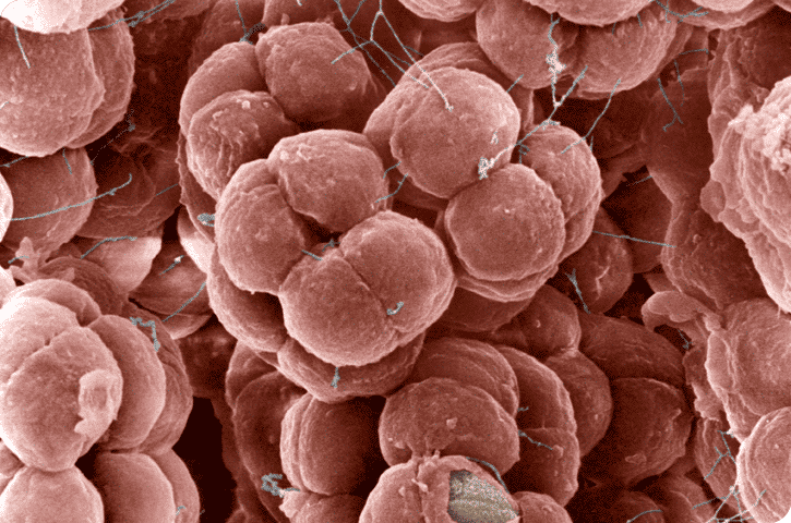 Des archées <em>Halococcus salifodinae.</em> Ces organismes unicellulaires qui vivent à des pH compris entre 6,8 et 9,5 ont été isolés d’une mine de sel en Australie. © Eye Of Science, Science Photo Library