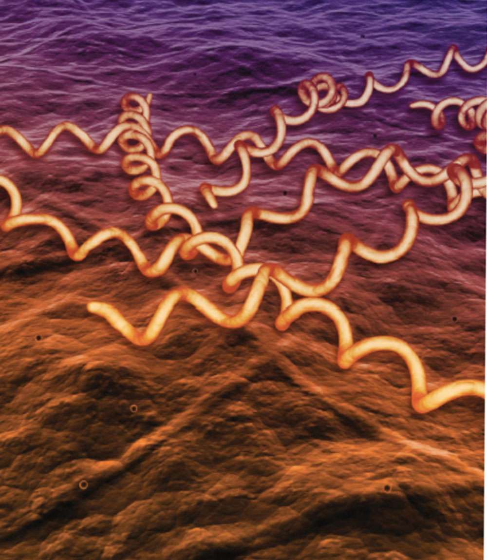 La syphilis est une maladie sexuellement transmissible due au spirochète <em>Treponema pallidum</em>, visible ici sous forme de longues cellules enroulées en spirale. © Dunod