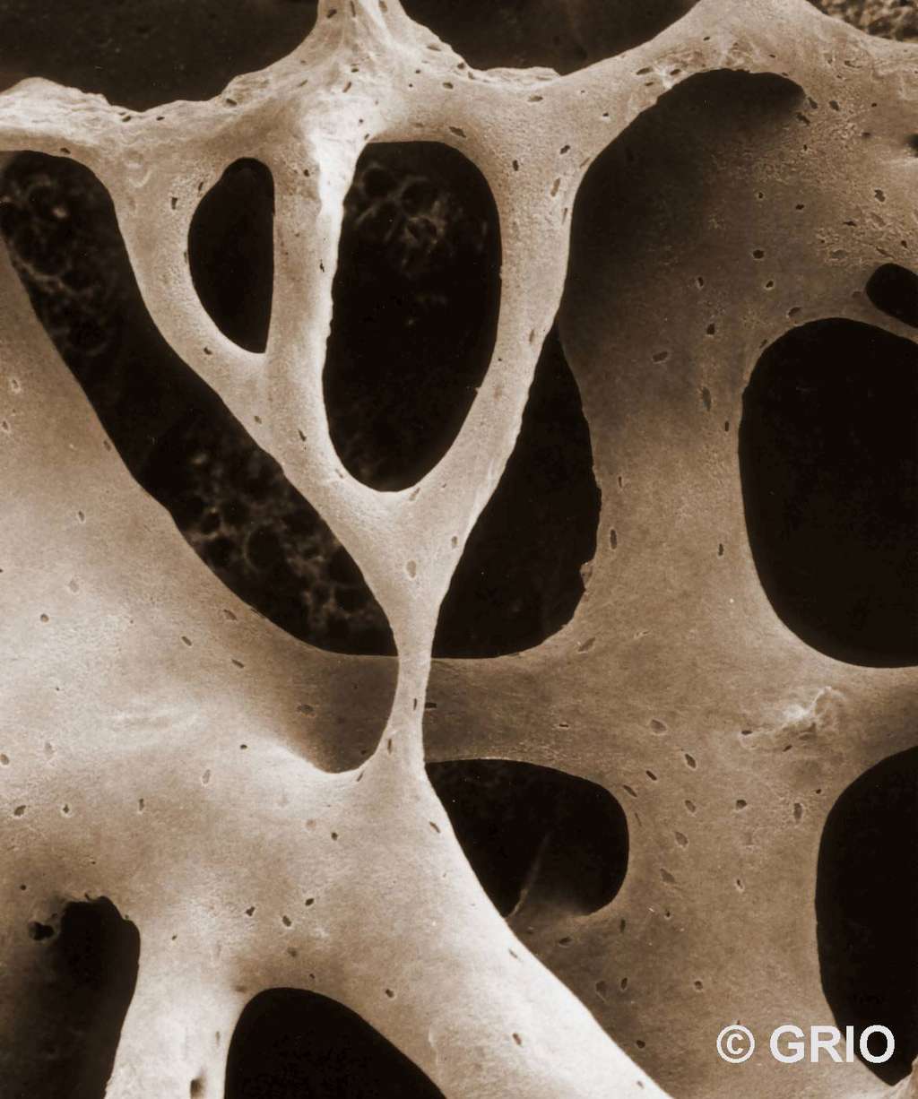 Trame osseuse (microscopie électronique à balayage). © Groupe de recherche et d’information sur les ostéoporoses, reproduction autorisée par le GRIO, EDP Sciences, tous droits réservés