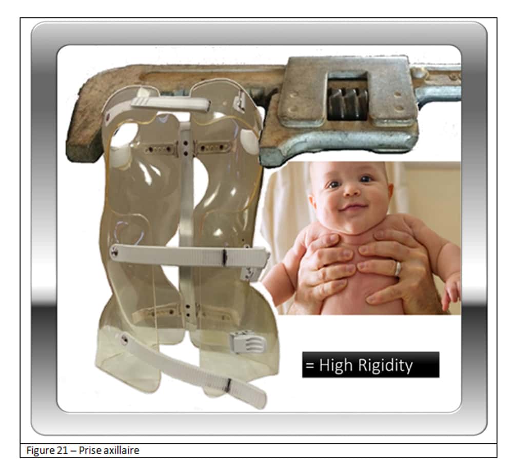 Pour un corset, comme lorsque l’on prend un bébé, la prise est latérale au niveau axillaire. © Docteur Jean-Claude de Mauroy. Tous droits réservés/Reproduction interdite