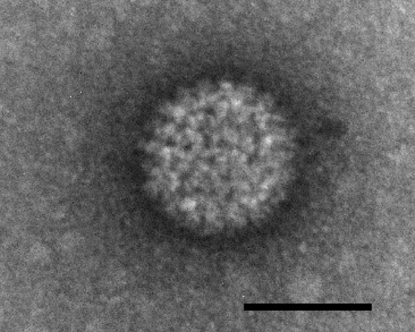 Virus de la langue bleue. © <em>Wikimedia commons</em>, DP