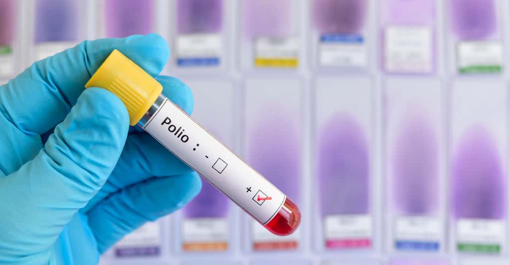 Prise de sang pour détecter le virus de la polio. © Jarun Ontakrai, Shuttestock