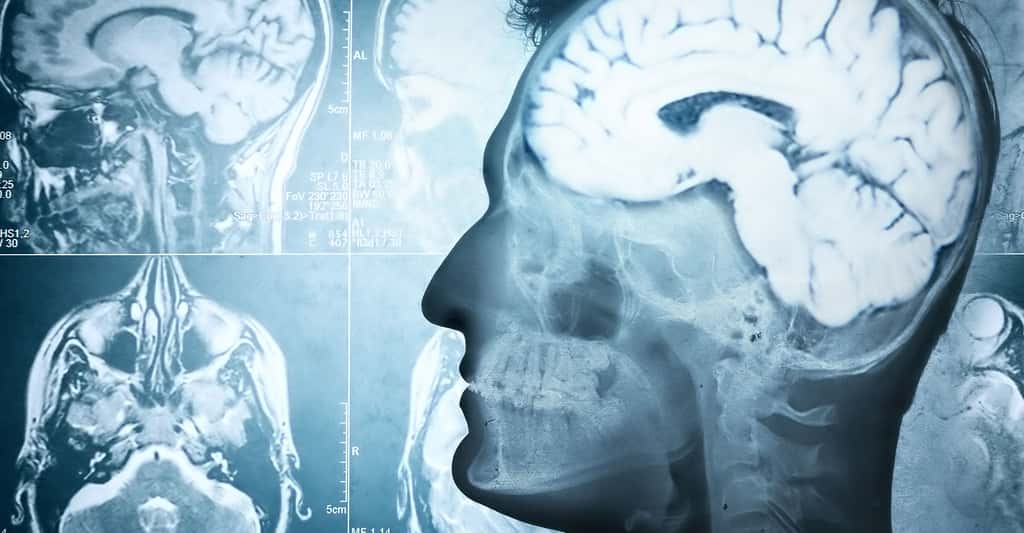 Comment détecter la maladie de Parkinson ? Quels en sont les symptômes ? © Triff, Shutterstock