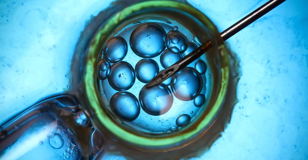 Injection d'un spermatozoïde par une micro-pipette. © Nevodka - Shutterstock
