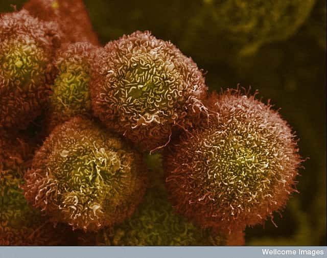 Image de microscopie électronique de cellules cancéreuses du pancréas. Ces cellules ont une multiplication rapide et ont élaboré une stratégie pour résister au stress nutritionnel. © Wellcome Images, Flickr, cc by nc nd 2.0