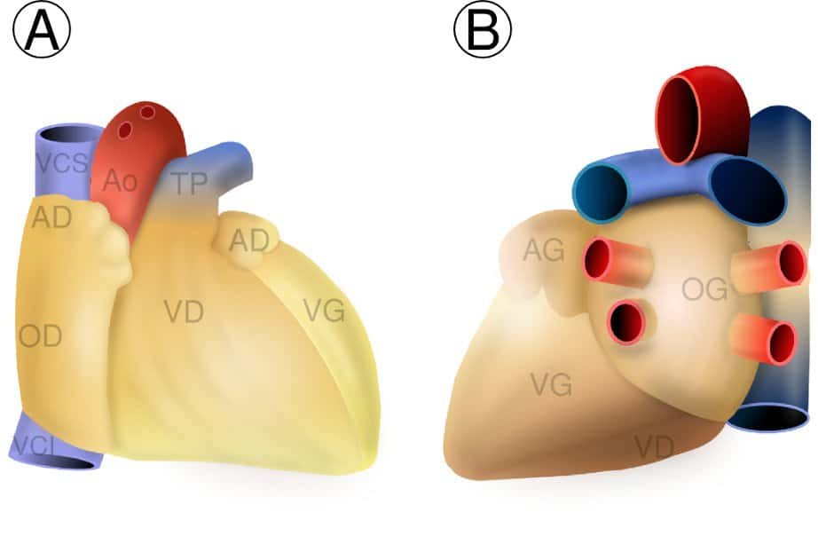 Figure 2. Anatomie externe du cœur humain. A : vue antérieure du cœur ; B: vue basale du cœur. AD : auricule droit ; AG : auricule gauche ; Ao : aorte ; OD : oreillette droite ; VCI : veine cave inférieure ; TP : tronc pulmonaire ; VCS : veine cave supérieure ; VD : ventricule droit ; VG : ventricule gauche. © Hugues Jacobs