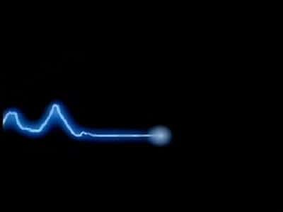 Souvent symbole du décès d'une personne dans un film ou une série, l'électrocardiogramme plat désigne la fin de l'activité électrique du cœur. © DR