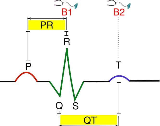 Figure 7. Activité électrique du cœur humain. L'électrocardiogramme normal chez l'homme. P : contraction des oreillettes ; QRS : contraction des ventricules ; T : relaxation des ventricules. Intervalle PQ : temps de conduction atrioventriculaire ; intervalle QT : durée de la contraction des ventricules. B1 et B2 correspondent au temps où l'on peut entendre les bruits du cœur à l'auscultation. © Hugues Jacobs