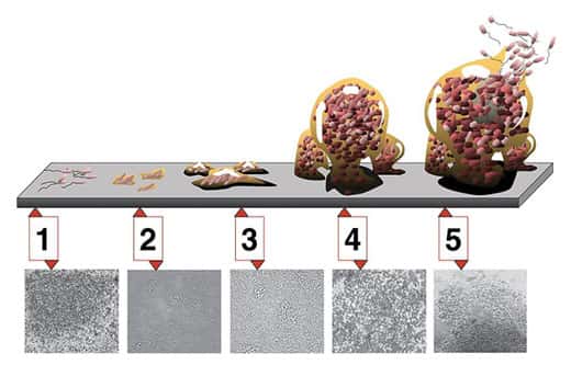 Les cinq étapes du développement d'un biofilm sur une surface dure. Étape 1 : attachement initial ; étape 2 : attachement irréversible ; étape 3 : apparition et maturation I du biofilm ; étape 4 : maturation II ; étape 5 : dispersion. Les photomicrographies (toutes à même échelle) sont celles d'un biofilm de <em>Pseudomonas aeruginosa</em> en développement. © D. Davis CC paternité 2.5 générique