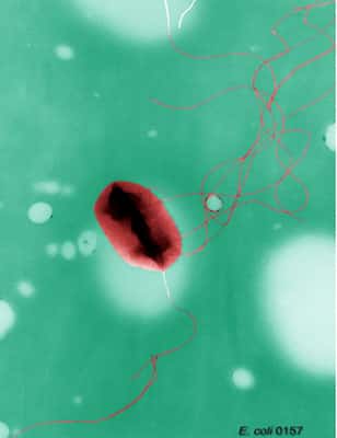 Photo en microscopie électronique des flagelles d'une souche de <em>Escherichia coli. ©</em> Domaine public