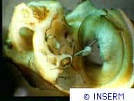 Oreille moyenne de cobaye : tympan et chaîne des osselets (au microscope optique à dissection). © Inserm
