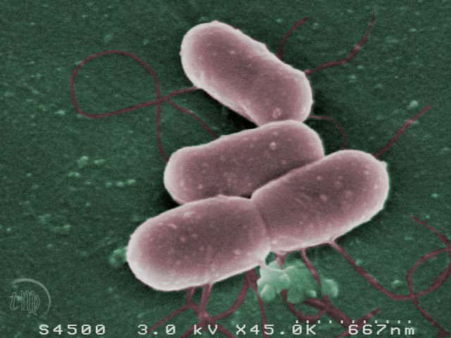 Listeria monocytogenes est une bactérie qui se retrouve dans de nombreux environnements. Elle touche préférentiellement les personnes dont le système immunitaire est altéré ou immature : personnes âgées, malades, femmes enceintes et nouveau-nés, qui sont plus facilement victimes de maladies infectieuses.&amp;nbsp;© Thierry Meylheuc, plateforme MIMA2, Micalis, Massy/Inra