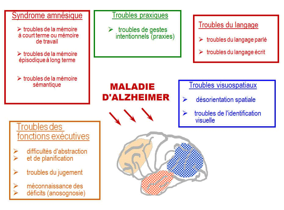 Les troubles causés par la maladie d’Alzheimer sont variés. © DR