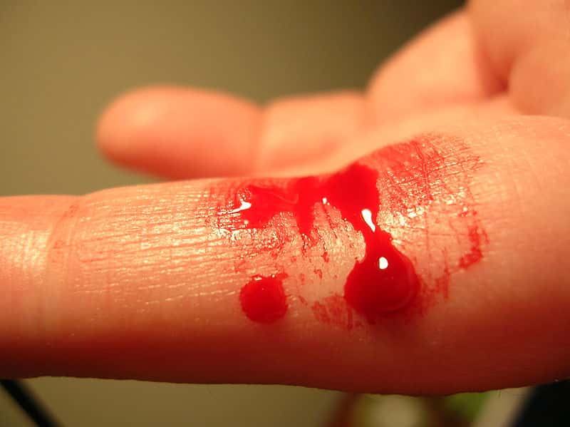 L'hémophilie conduit à un défaut de coagulation du sang lors des hémorragies. © Crystal, Flickr, CC by sa 2.0