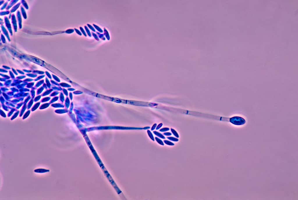Sur cette image, on voit les conidiophores et les conidies du champignon <em>Fusarium verticillioides</em>. Faisant partie de la flore des champs, ce champignon ne se développe pas sur les grains une fois récoltés. © CDC, Libero Ajello, DP