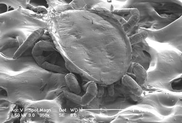 Image d'un acarien au microscope électronique à balayage. Bien que celui-ci soit microscopique, les plus grands acariens peuvent dépasser le centimètre. © R.B., DP
