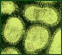 Virus de la grippe observés au microscope électronique à transmission. © DR