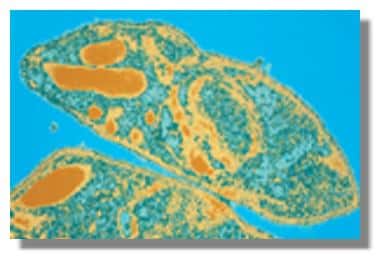 Plasmodium falciparum. Hématozoaire du paludisme (anciennement appelé malaria) transmis par l'anophèle (grossissement x 75000). &copy; Institut Pasteur 