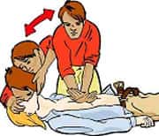 Pratiquez le bouche-à-bouche toutes les cinq compressions thoraciques. © Croix-Rouge française, G. Pascaud​​​​​