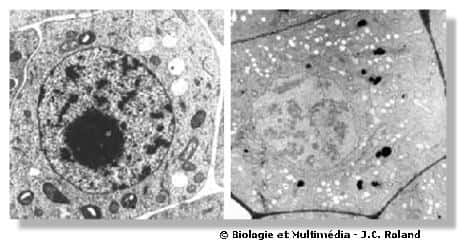 Figures 7 et 8 - Ultrastructure de cellules (cellules méristématiques) de jeune racine de pois. A gauche, un contraste topographique met en évidence la structure de la plupart des organites cellulaires ; on distingue le noyau et dans le cytoplasme, des vésicules claires (jeunes vacuoles) des organites gris (mitochondries)  et des organites plus foncés contenant une inclusion blanche (proplastes) ; la paroi cellulaire qui entoure la cellule n'est pas contrastée. A droite, une technique cytochimique spécifique des polysaccharides, montre que les proplastes contiennent de l'amidon et que la paroi est constituée de cellulose