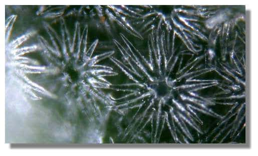  Figure 13. Poils étoilés de Psilotrichum vus de dessus. <br />© Biologie et Multimedia 