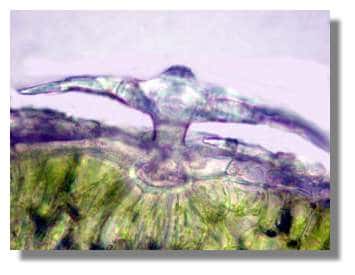  Figure 14. Poil de Psilotrichum vu en section. Ces poils d'origine épidermique ont une forme qui rappelle un parasol. <br />© Biologie et Multimedia 