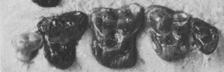 Dents fossiles d'<em>Adapisorex</em>. © Toute reproduction et utilisation interdites 