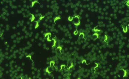 <br />Photo : 30 - Résultat d'un test positif en immunofluorescence indirecte. Les trypanosomes (souche entretenue au laboratoire) sont fluorescents car le sérum déposé sur la lame contenait des anticorps spécifiques. <br />&copy; Gérard Duvallet