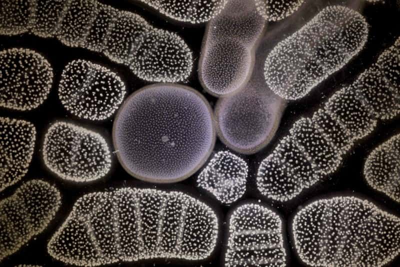Colonies de radiolaires <em>Collozum</em> : au stade colonial ce radiolaire est formé de l’agrégation de milliers de cellules individuelles qui se sont divisées (les points blancs). Les cellules produisent et vivent dans une gangue gélatineuse commune formant des sphères ou boudins longs de quelques centimètres. Leur teinte plus ou moins brune correspond à leur cycle de vie et à l’abondance d’algues symbiotiques (les petits points ocre). © C. Sardet CNRS