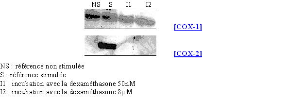 fig.77 : Action de la dexaméthasone sur la synthèse de COX-2.<br />