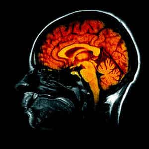 On estime que le cerveau contient un peu plus de 100 milliards de neurones. © DR