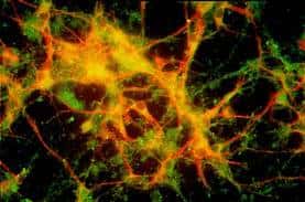 Culture de neurones corticaux de souris doublement marqués pour une protéine de structure, le MAP2 (en rouge) et une protéine du métabolisme, un transporteur de monocarboxylates (en vert). © Karin Pierre, Institut de Physiologie, UNIL, Lausanne, DR