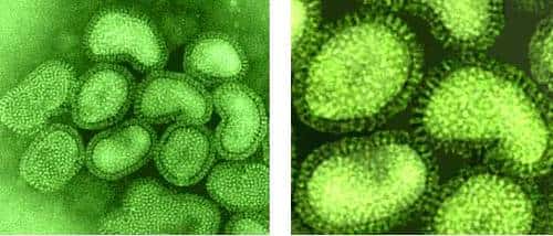 Virus influenza en microscopie électronique - L'hémagglutinine de l'enveloppe forme un halo caractéristique autour des particules virales en coloration négative. © Images courtesy of Linda M. Stannard, University of Cape Town