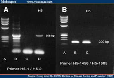 Diagnostic par technique de RT-PCR du virus H5. © <em>Center for disease control and prevention</em>, reproduction et utilisation interdites