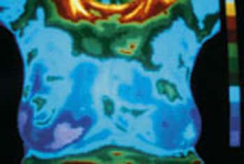 Dépistage du cancer du sein. Image obtenue en tomovélographie (scanner à ultrasons). © M. Depardieu/Inserm - Reproduction et utilisation interdites