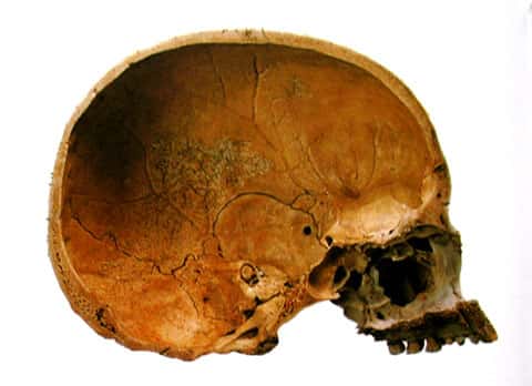 Crâne de <em>Homo sapiens</em> (coupe). © DR