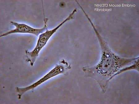 Les fibroblastes sont aussi appelés cellules de soutien. Dans le derme, ces cellules en assurent la cohérence et la souplesse. © Subtle Guest, GNU 1.2