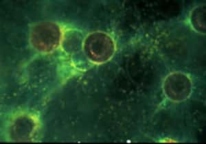 Colonie de radiolaires et ses zooxanthelles symbiontes, vue sous le microscope optique (environ 100 µm). On distingue bien la capsule centrale rougeâtre et le noyau des radiolaires. Les nombreuses zooxanthelles jaunâtres sont éparses dans l'ectoplasme de la colonie pour profiter au mieux de la lumière. © N. Swanberg
