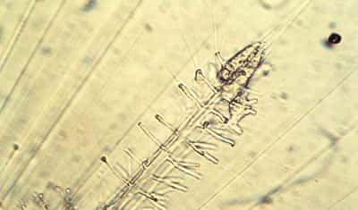 Reconstruction d'une épine cassée de radiolaire (<em>Octodendron</em>). Un manchon granuleux se forme et précède une épine en silice reconstruite en une heure. Les traits irisés correspondent à des axopodes (caractéristiques des radiolaires). © N. Swanberg 