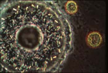Capsule centrale pendant un stade de reproduction. On y voit des cristaux de SrSO<sub>4</sub> (qui existent pendant cette phase particulière), des granules pigmentés bleus, une grosse gouttelette lipidique centrale, la membrane de la capsule centrale et des zooxanthelles symbiotiques à l'extérieur (vert-jaune). Diamètre des zooxanthelles : 10 µm. © N. Swanberg 