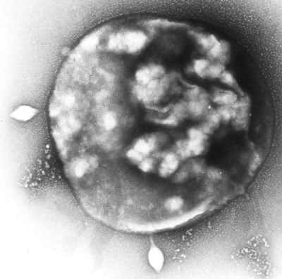 Sulfolobus (ici, infecté par un virus). © Xiaoyu Xiang Wikipedia