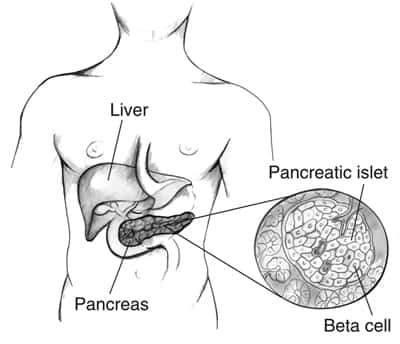 Situation du pancréas dans le corps humain : sans l’insuline produite par les cellules bêta (β) (<em>Beta cell</em>, en anglais sur ce schéma) des îlots de Langerhans (<em>Pancreatic islet</em>) du pancréas, organe situé sous le foie (<em>Liver</em>), le taux de glucose dans le sang (glycémie) augmente indéniablement, provoquant une hyperglycémie. © <em>National Institute of Diabetes and Digestive and Kidney Diseases, National Institutes of Health</em>