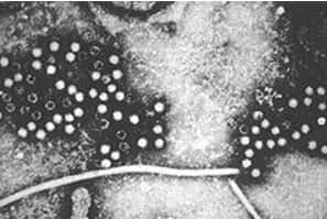 Observation du virus de l'hépatite E au microscope électronique © Center for Disease Control and Prevention, US States Department of Health and Human Services, Wikimedia Commons. Domaine public.