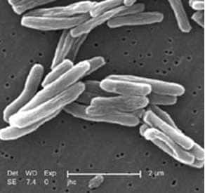 Visualisation de Mycobacterium tuberculosis au microscope électronique<br />Source : Centers for Disease Control and Prevention, NIH, domaine public. © Wikimedia Commons 